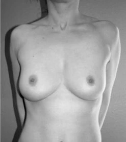 Binder Poitrine Court - Blanc 33 Binder Poitrine Court - Blanc -Maison Close Magasin chestbinderbusteseinsface 1 3